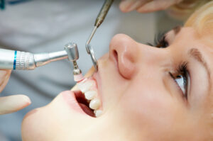 Dental-Cleaning-Consultation