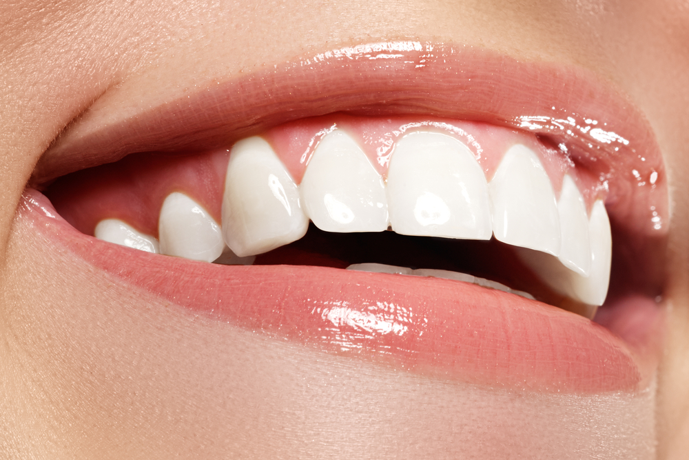 Zoom-Teeth-Whitening